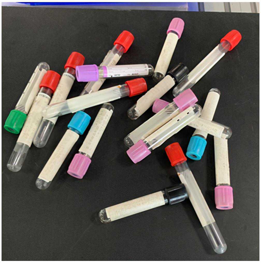 基于三维机器视觉的采血试管分拣系统