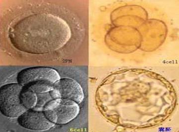 震撼：实拍体外受精培育试管婴儿全过程