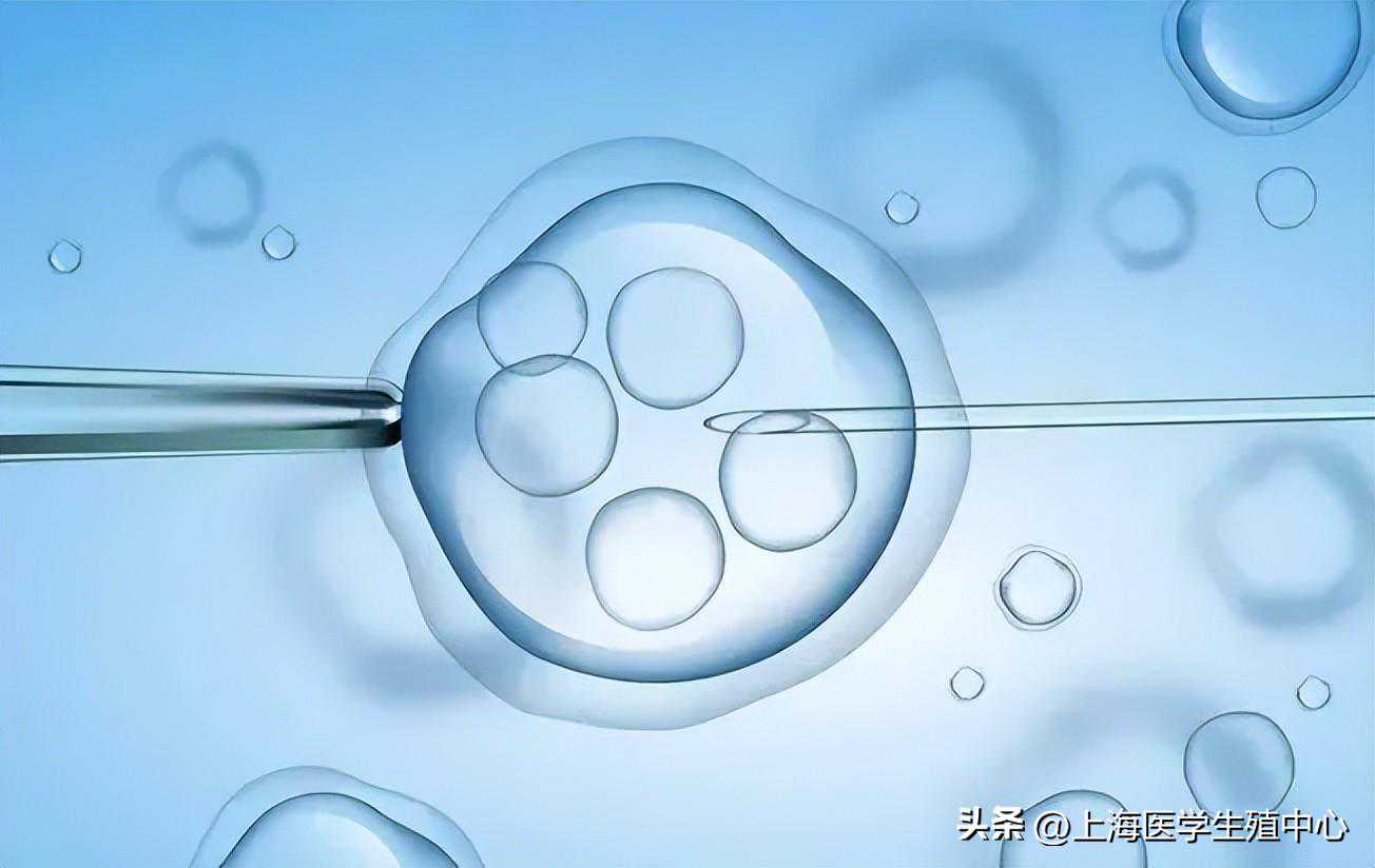 9个试管婴儿攻略步骤，还没生孩子的你，收藏起来没准能用上