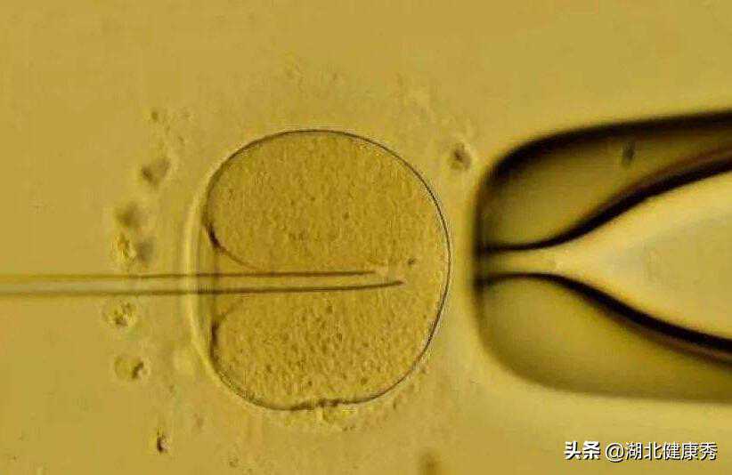 做试管婴儿过程中，每个人都要闯5大难关，战到最后才是胜者