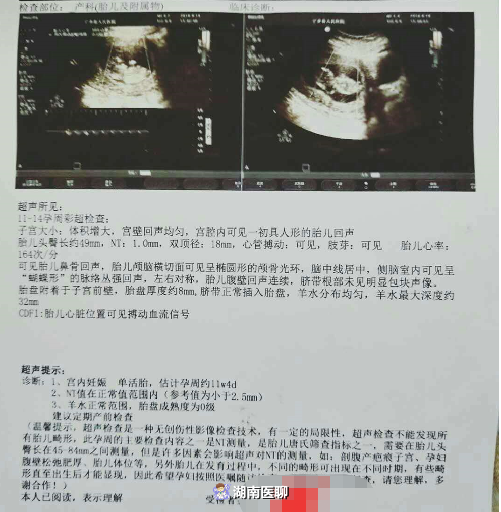 不孕症专家：备孕之路复杂难行？讲两个成功怀上的故事