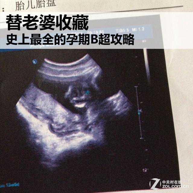史上最全的孕期B超攻略