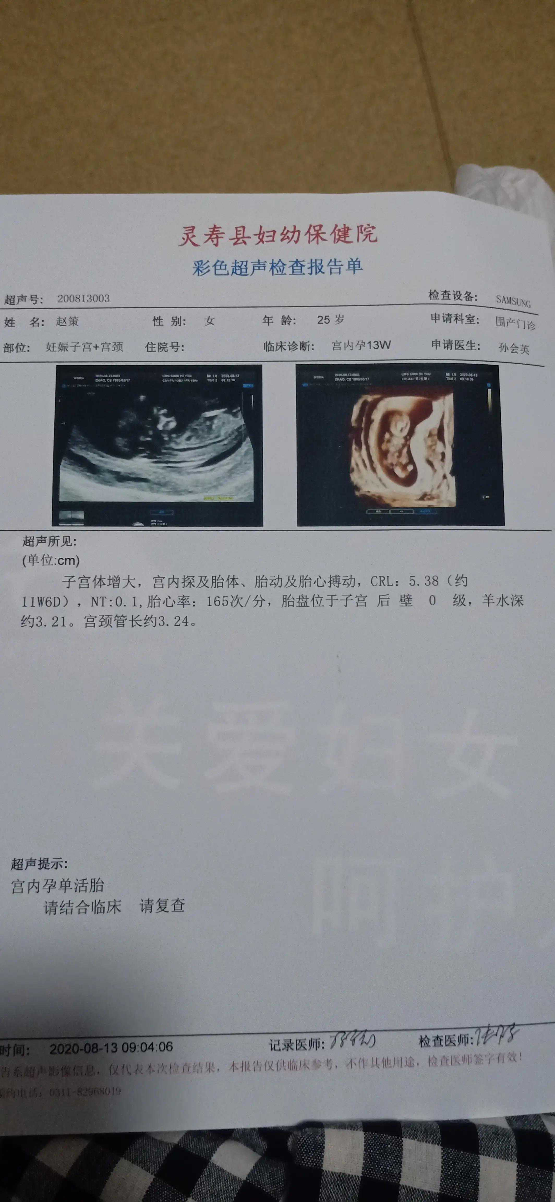 准妈妈必读-孕期记录—关于nt检查